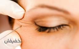  تزریق ژل با برترین برندهای روز 