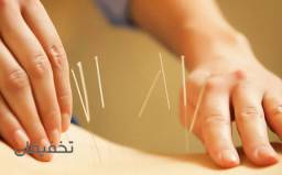 طب سوزنی جلسه ای