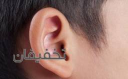 لیزر موهای زاید پیشانی یا کنار گوش با دستگاه تیتانیوم سوپرانو آیس 2023در کلینیک زیبایی آوینا با 25% تخفیف