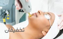 لیزر موهای زاید زیر چانه با دستگاه سوپرانو تیتانیوم آیس 2023 در کلینیک زیبایی آوینا با 30% تخفیف