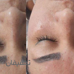  فشیال تخصصی پوست با بهترین مواد 