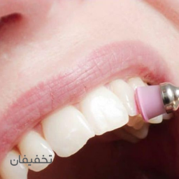 جرمگیری و بروساژ