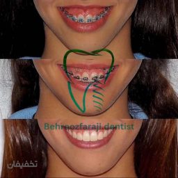 ارتودنسی درجه 1 اروپایی اخرین تکنولوژی روز