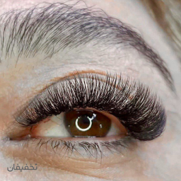 کاشت مژه 