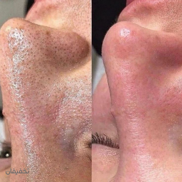 پاکسازی پایه