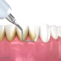جرمگیری و بروساژ دو فک تخصصی