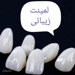 20 واحد دندان، لمینت، زیبائی