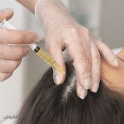 یک جلسه هیر فیلر از برند DR-CYJاز کشور کره جنوبی