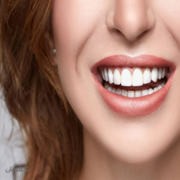 جرم گیری و بروساژ