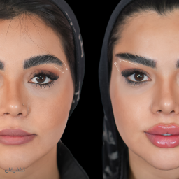 ليفت نخ ابرو و افتادگي چشم