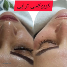 تخفیف فیشال به مدت محدود 
