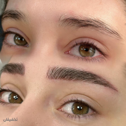 میکروبلیدینگ