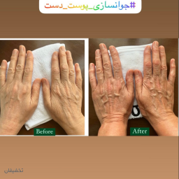 فیشال تخصصی جوانسازی