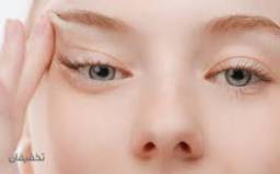 بوتاکس چشم گربه ای 