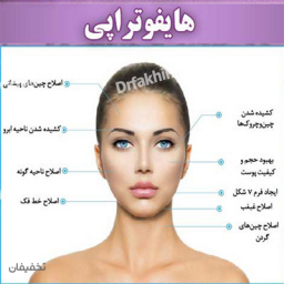 هایفوتراپی آیشید