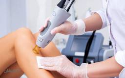 لیزر ساق پاها در مطب زیبایی زیبا رویان با دستگاه سوپرانو تیتانیوم 2025 با 35% تخفیف