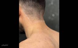 پشت گردن ویژه آقایان