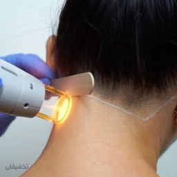 لیزر موهای زائد ویژه پشت گردن در کلینیک دکتر لیزر