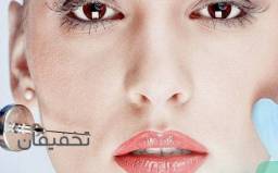 تزریق هر سی سی ژل کره ای گرید A در مرکز زیبایی آبادیس