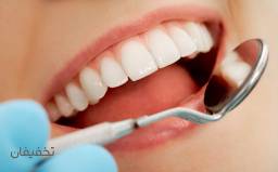 جرم گیری و بروساژ هر دوفک