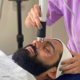 فشیال صورت