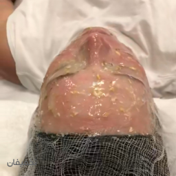 فیشال