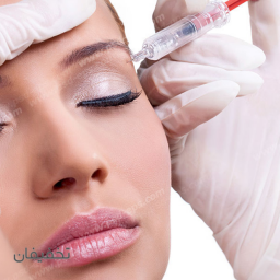 بوتاکس دیستون