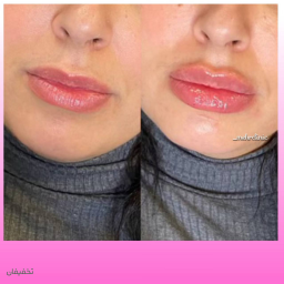 ژل لب روش روسی