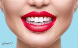 جرمگیری و برساژ هردوفک