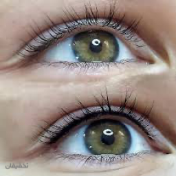 بن مژه در مرکزجهان