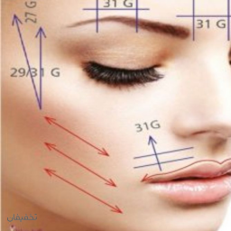 نخ مونو جهت جوانسازی