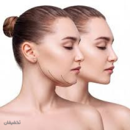 ساکشن غبغب در کلینیک دکتر قنبرپور