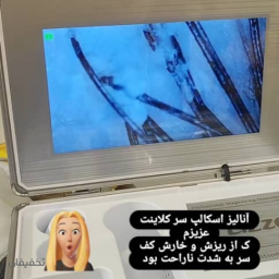 اسکالپ مو (مشاوره و آنالیز رایگان) در آرایشگاه بانو یزدانی