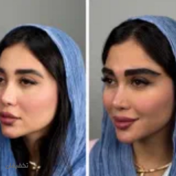 کاشت ابرو ومو