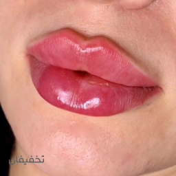 مطب دکتر آزاده محمد پور یزدی