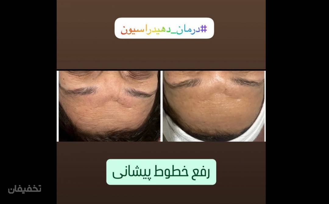 فیشال تخصصی پوست