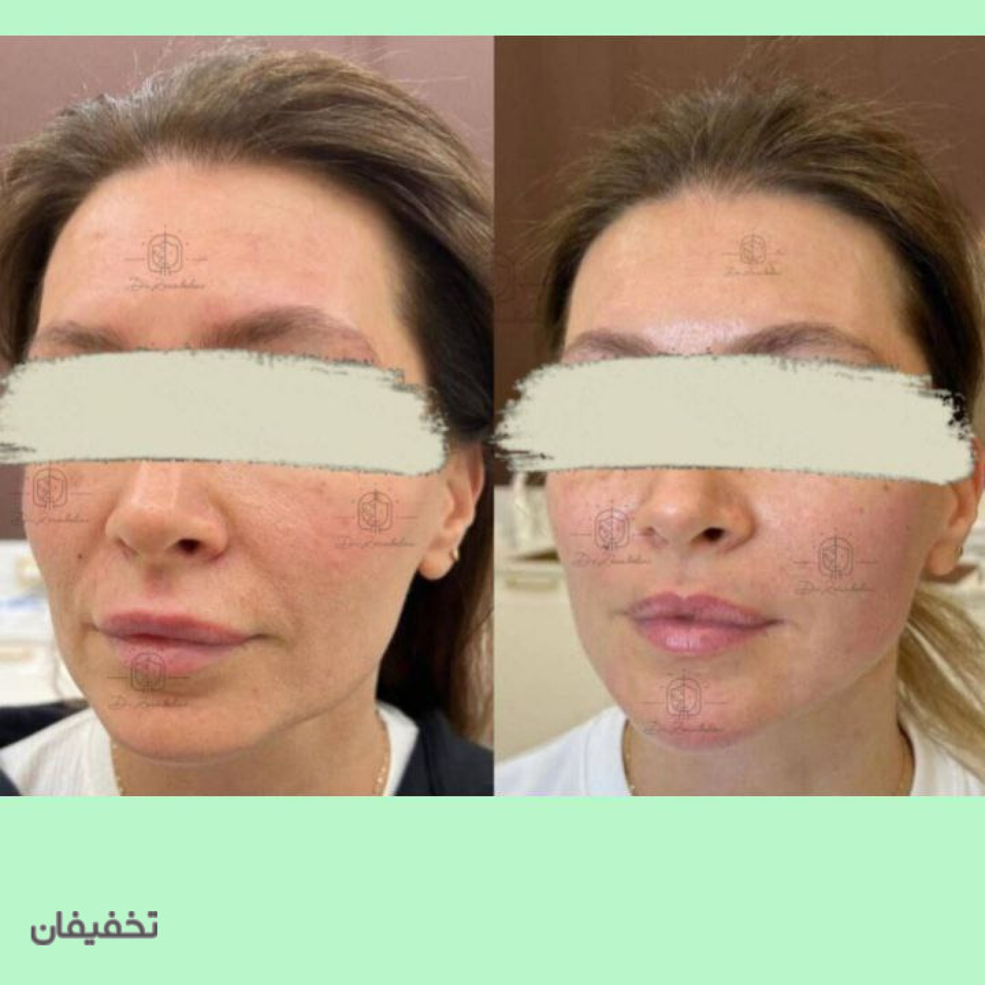 مطب پوست و زیبایی دکتر زرین بادینی