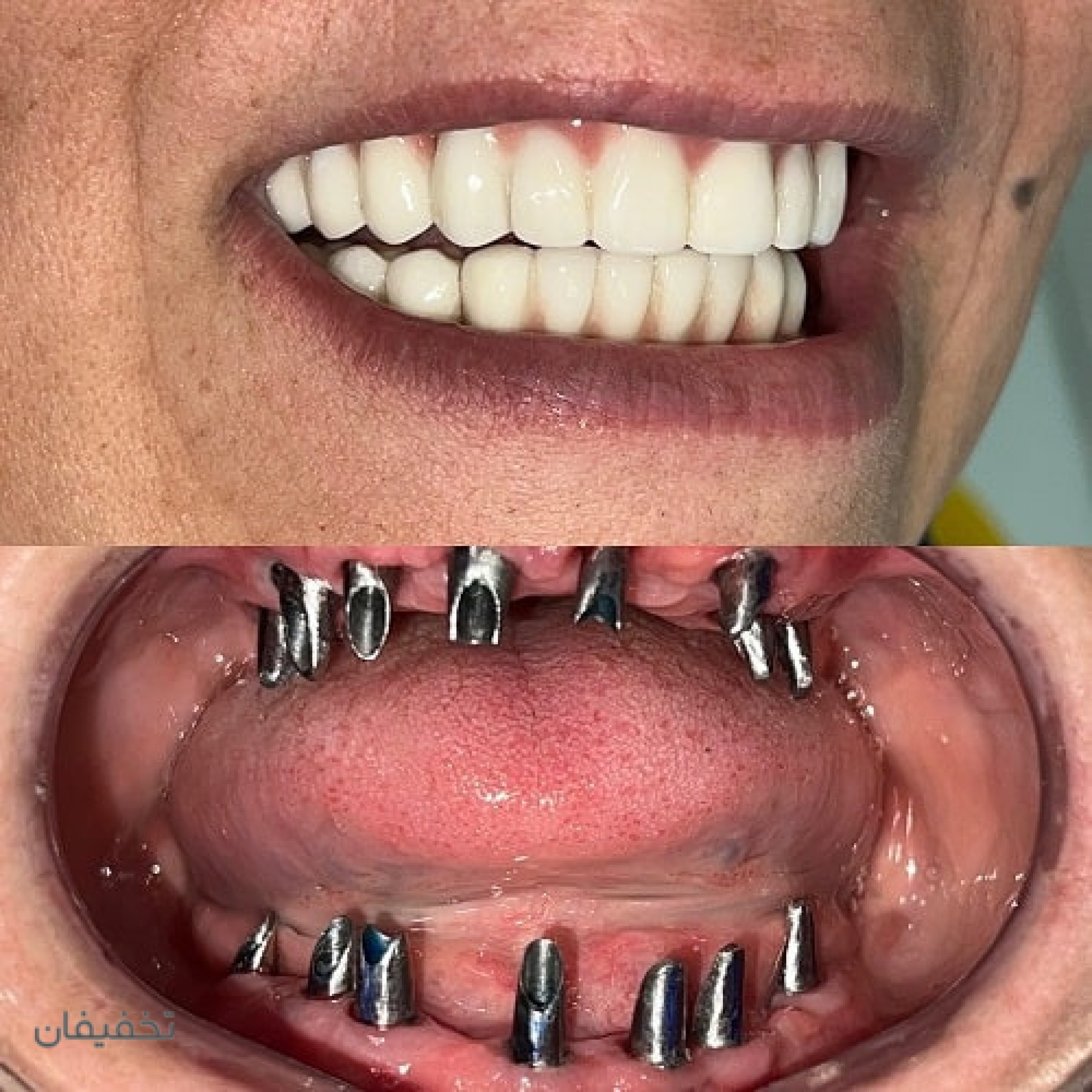 دندانپزشکی دکتر بهزاد  قائینی