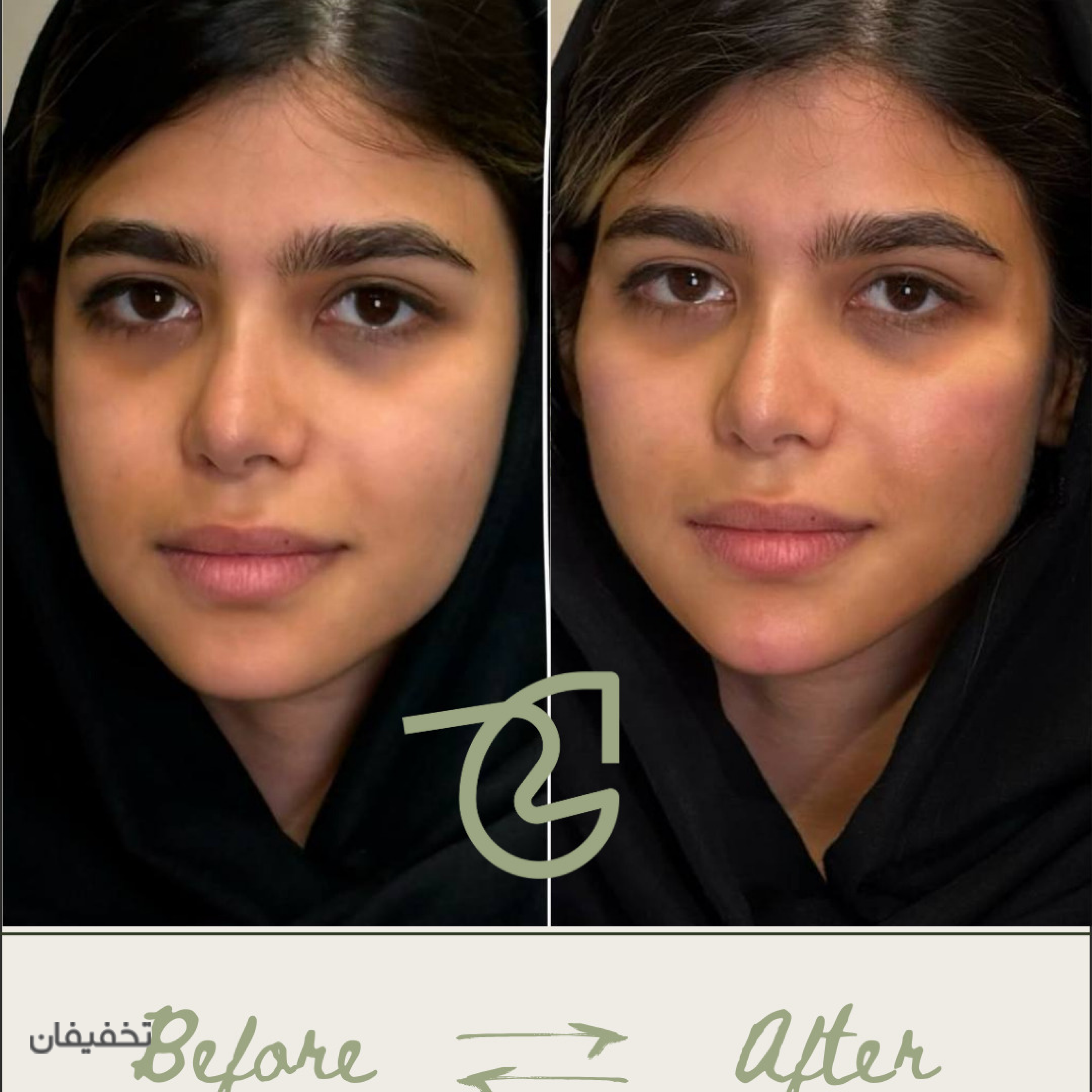 مرکز پوست و مو آئورا (شعبه جردن)