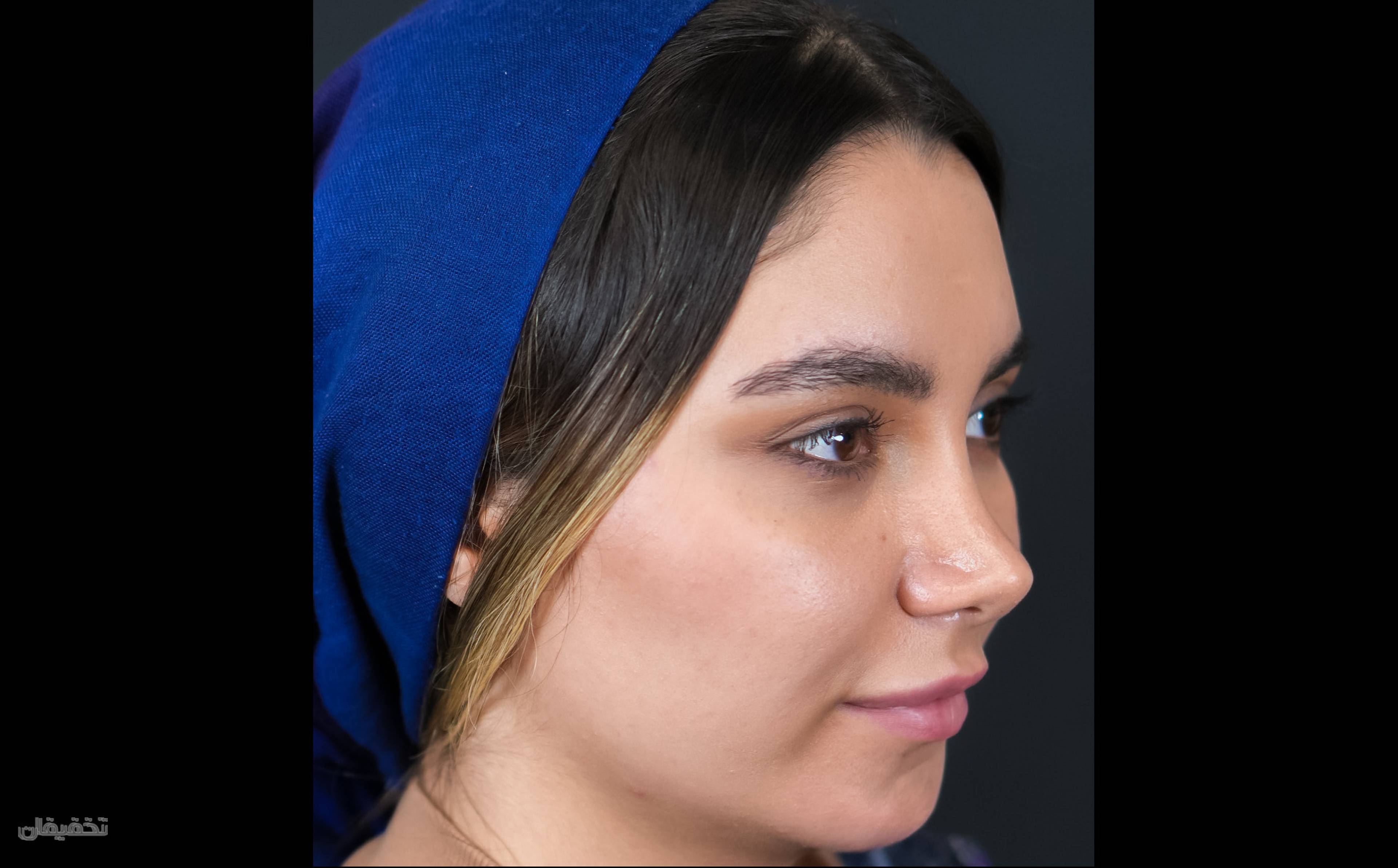 کلینیک زیبایی زیبانوم