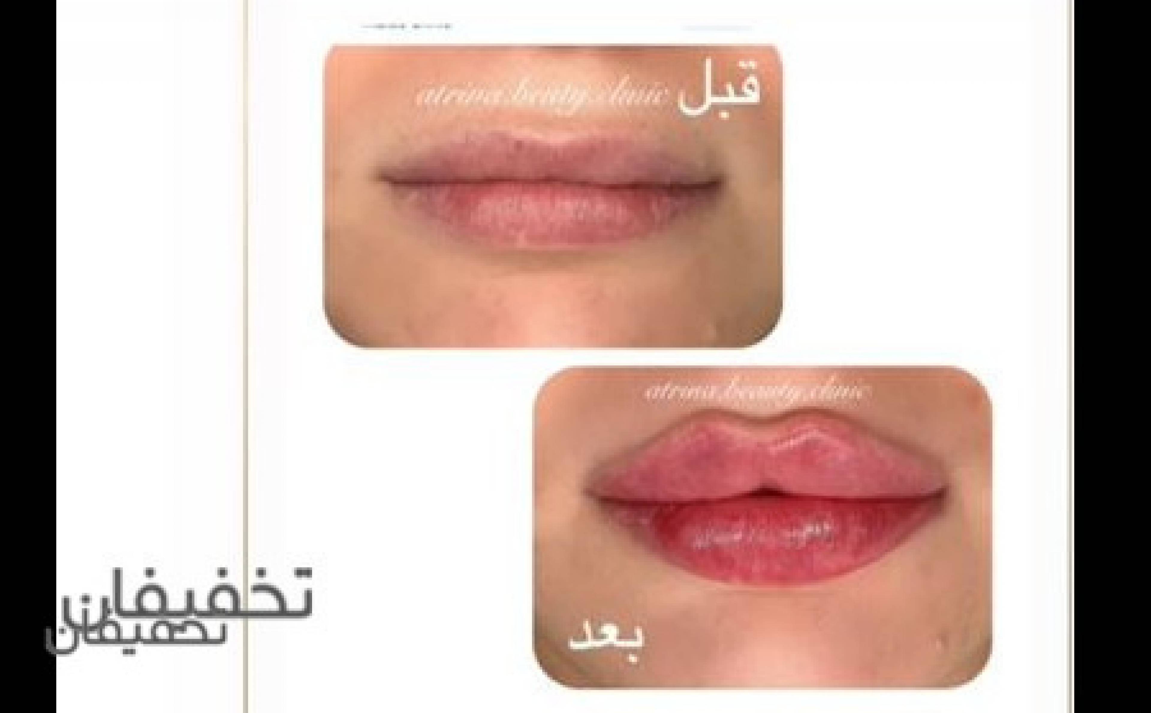 کلینیک زیبایی آترینا