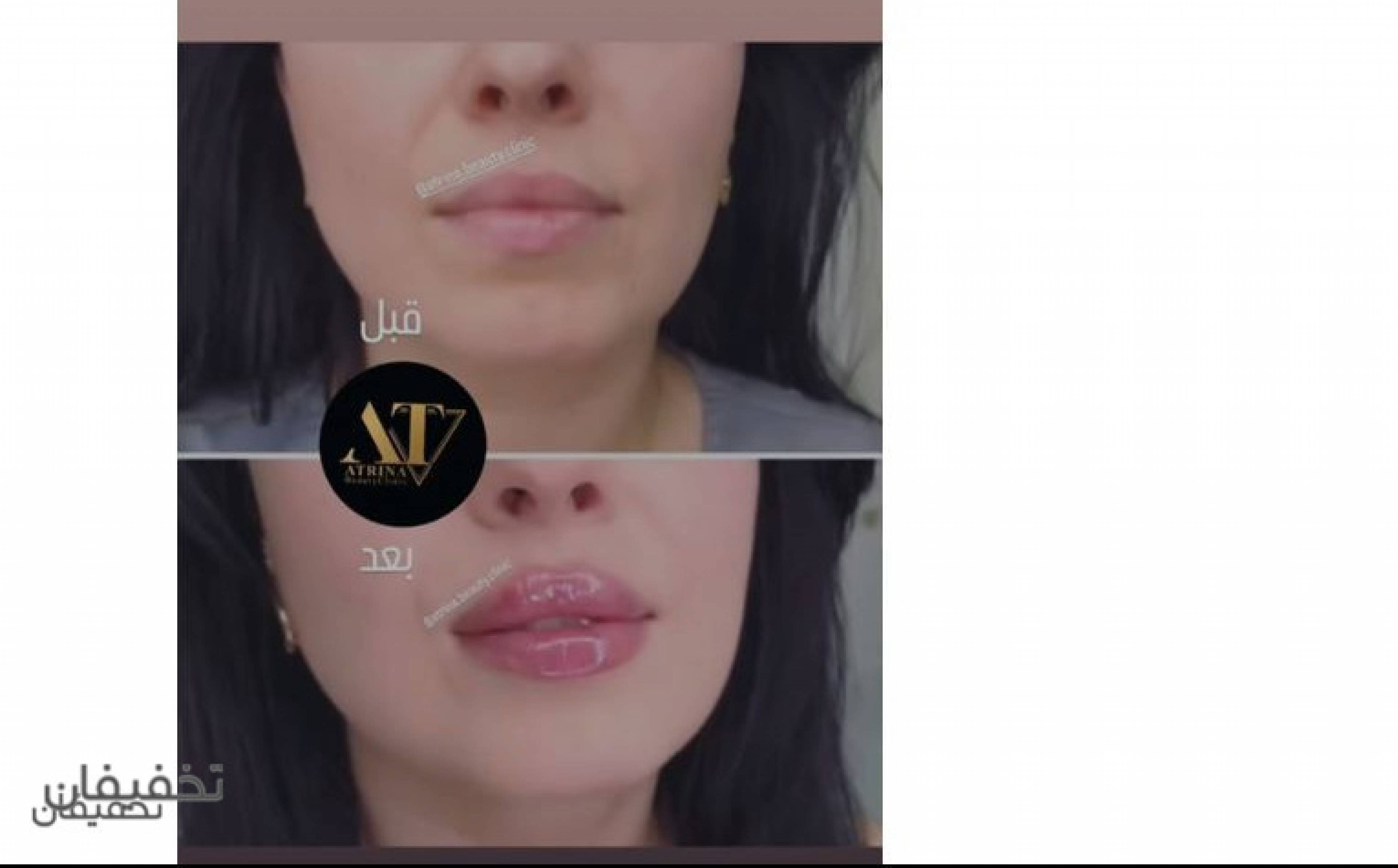 کلینیک زیبایی آترینا