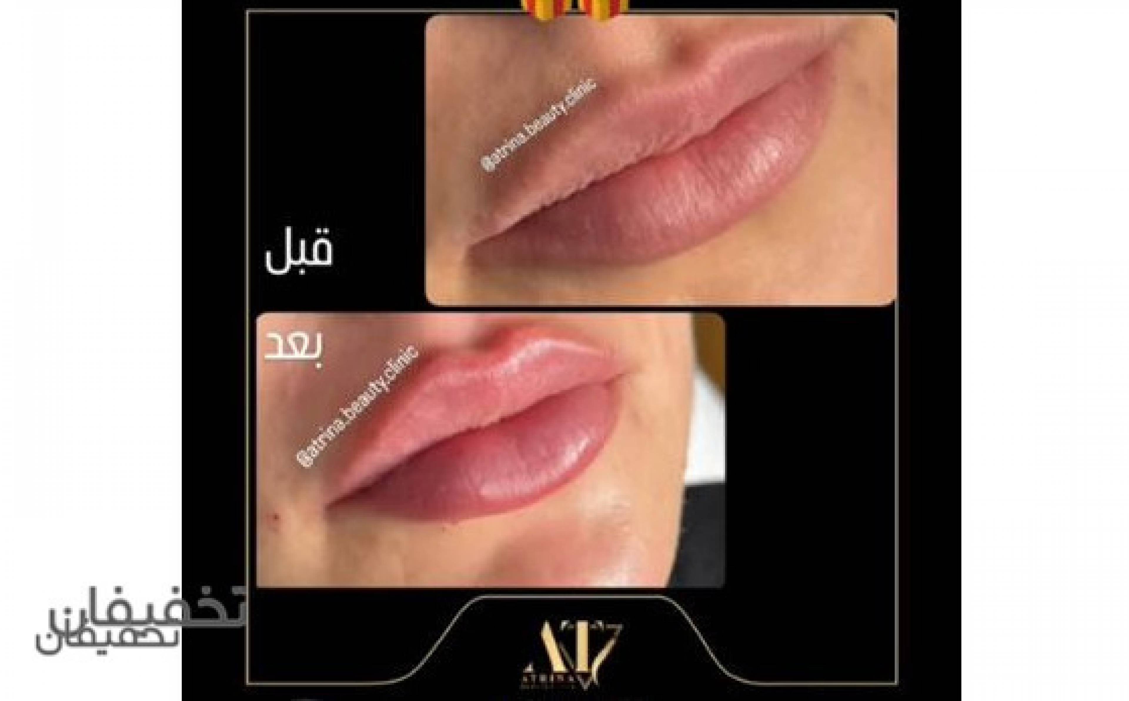 کلینیک زیبایی آترینا
