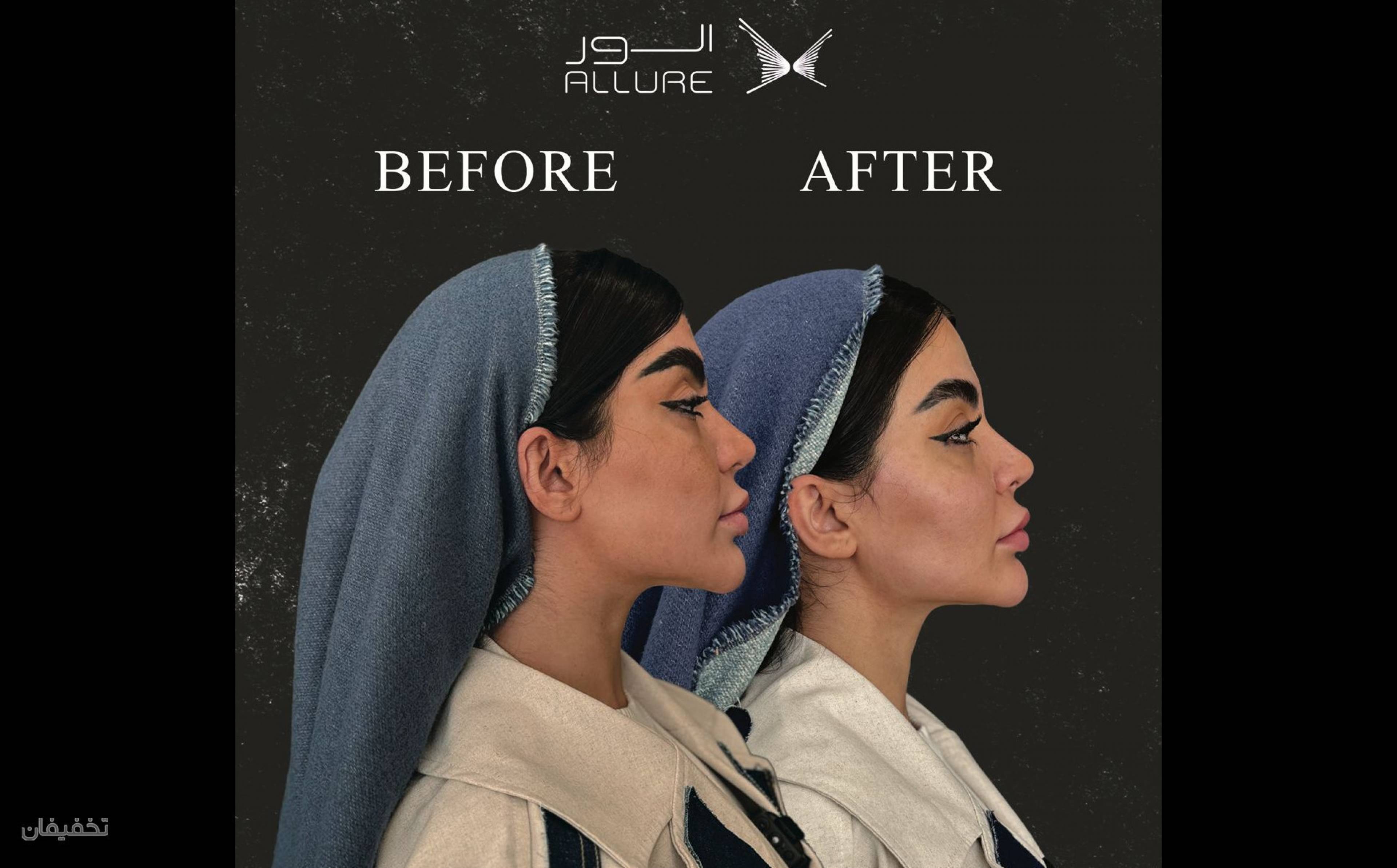مرکز زیبایی الور
