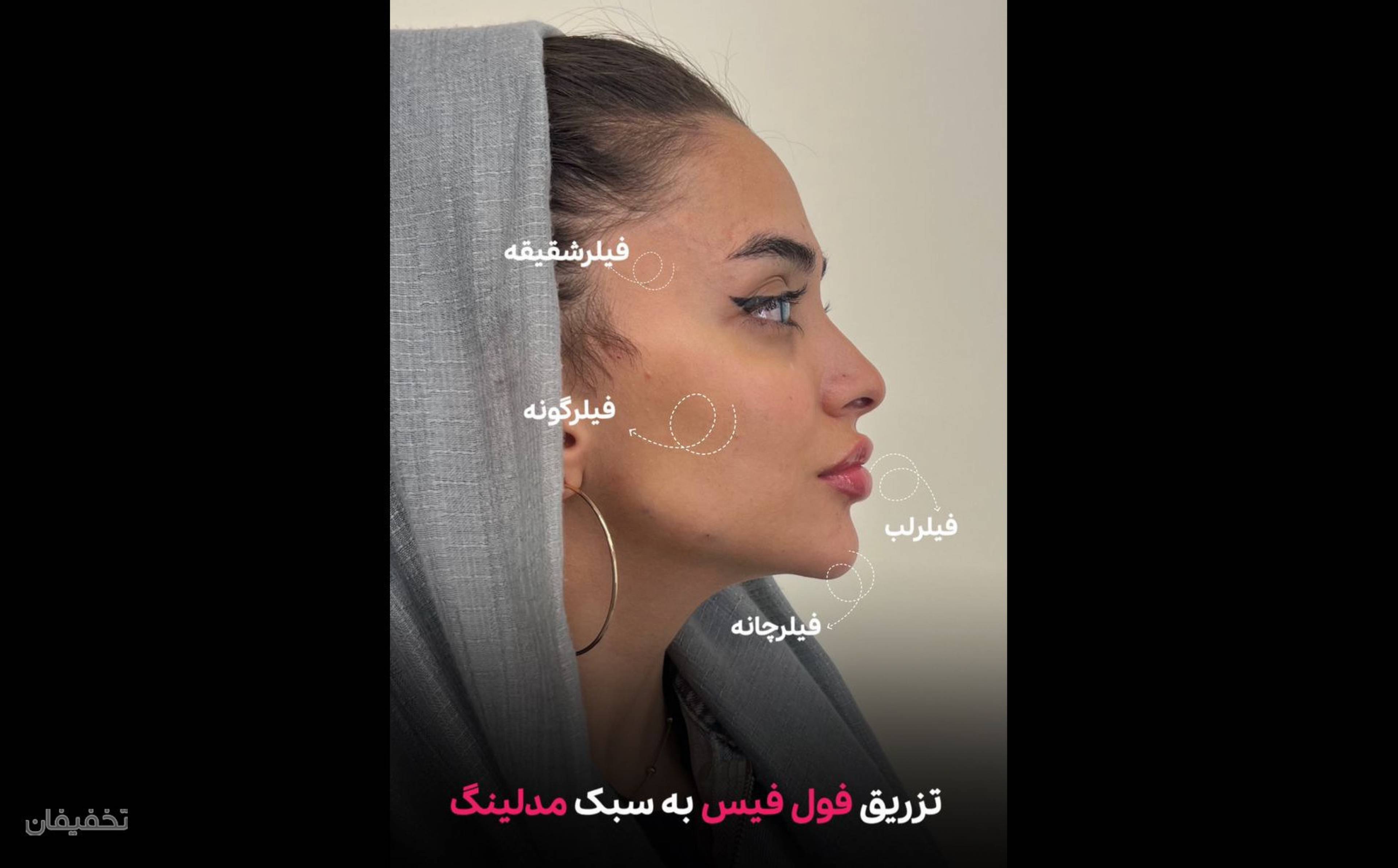 مرکز زیبایی الور
