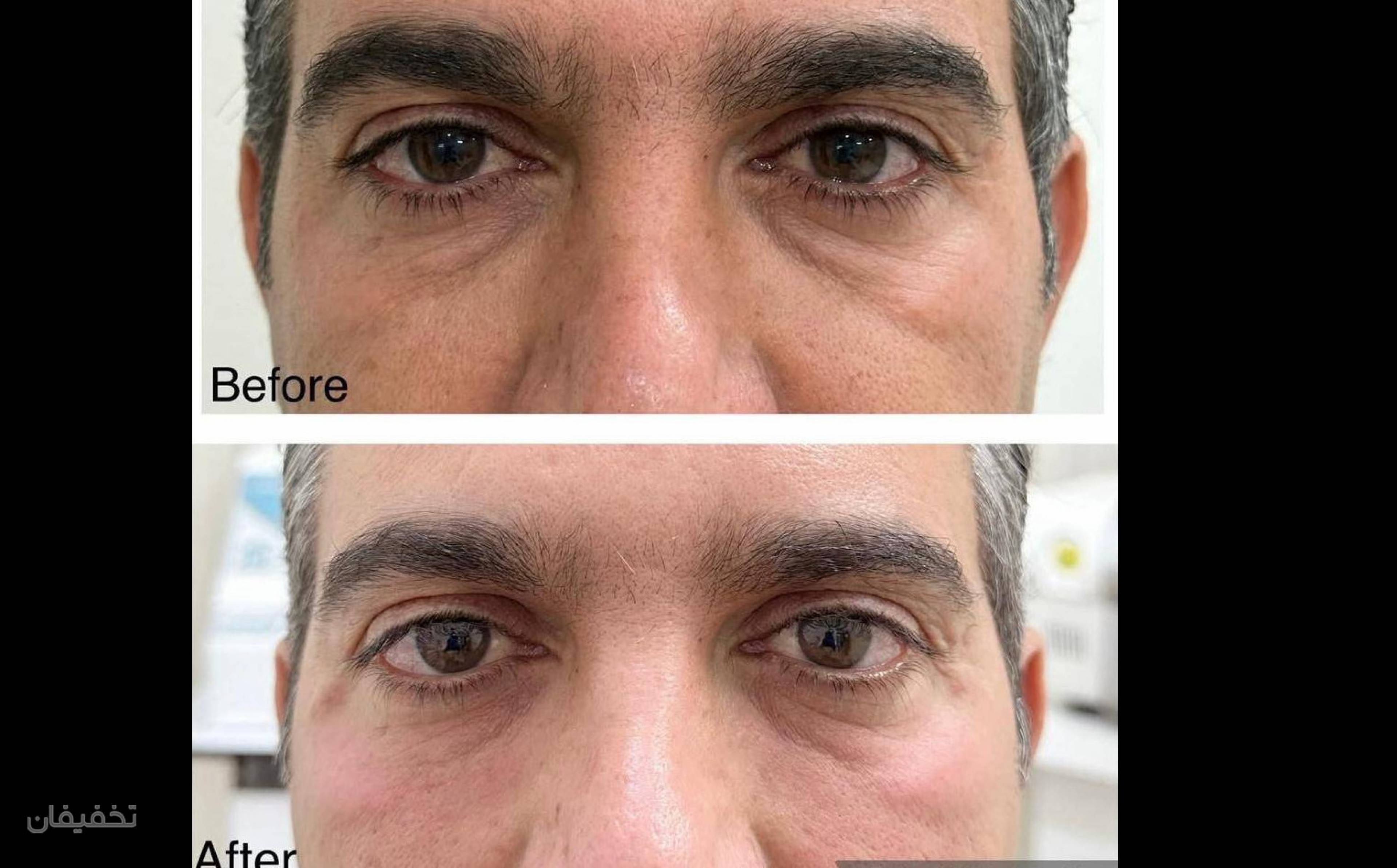مرکز لیزر و زیبایی آرانا