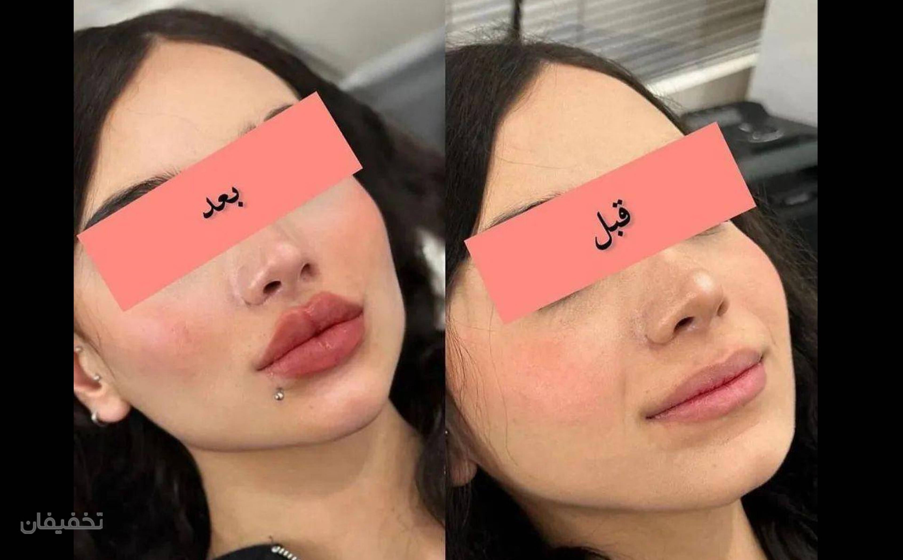 مرکز لیزر و زیبایی آرانا
