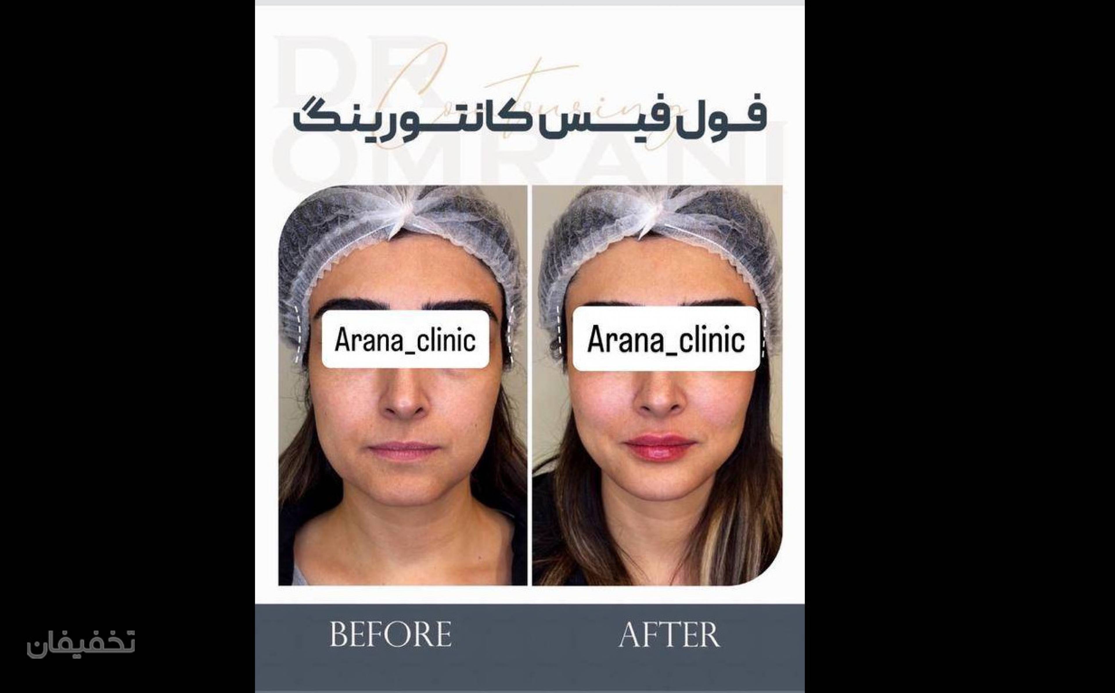 مرکز لیزر و زیبایی آرانا