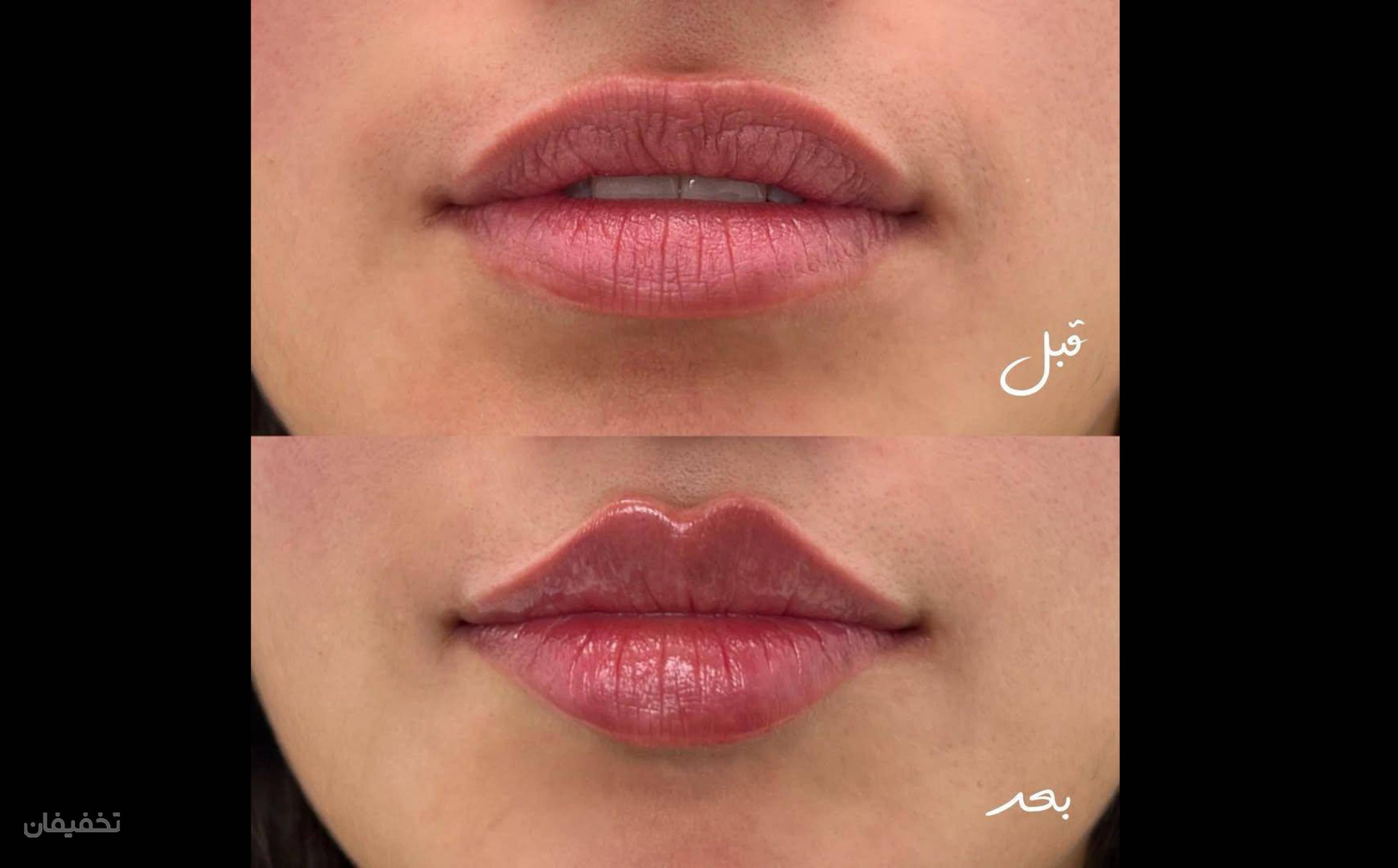 مرکز لیزر و زیبایی آرانا