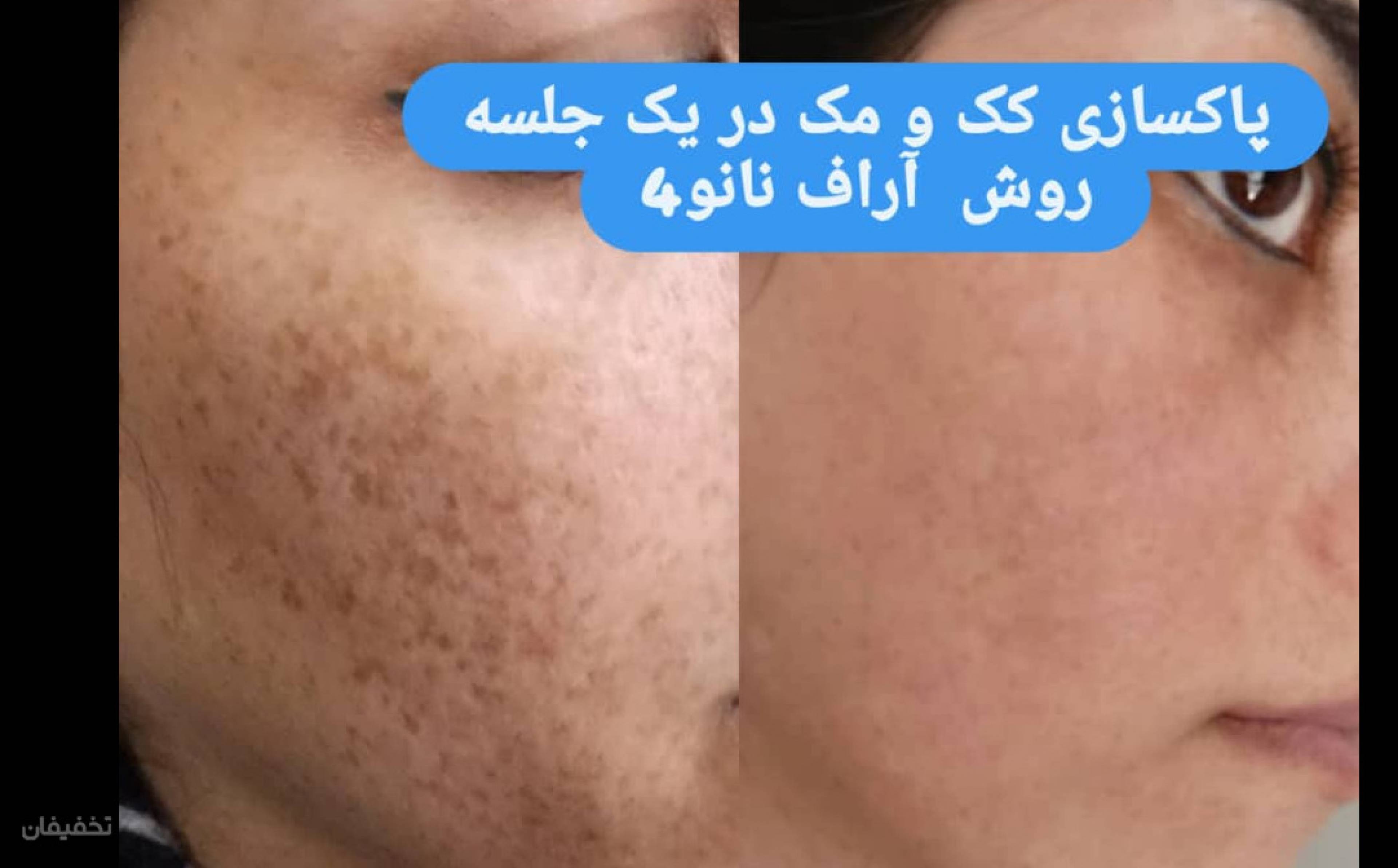 خدمات زیبایی و پوست فرحناز
